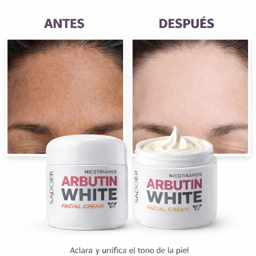 Arbutin White - Crema Aclarante